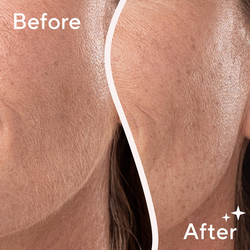 Lighted Electric Facial Exfoliator with 6 Replacement Heads L20327